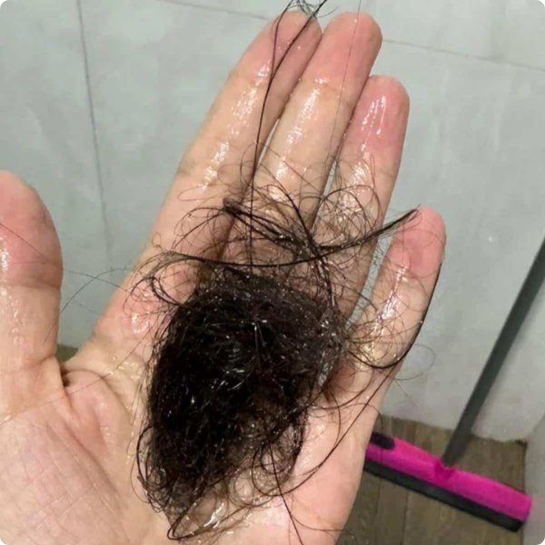Antes